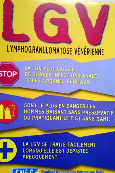 Lgv